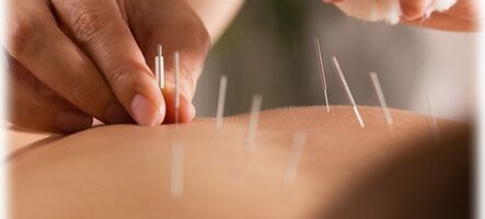 Kurz: Masáž suchou ihlou